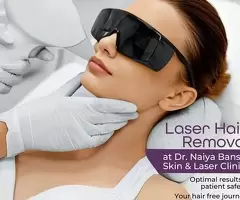 Dr Naiya Bansal's best Laser hair Remival in Chandigarh - Image 4